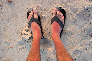 Sunburn on the feet with flip flops, view from above