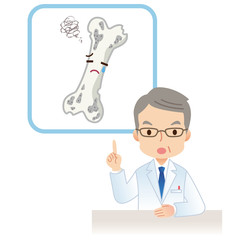骨粗鬆症　説明する医師