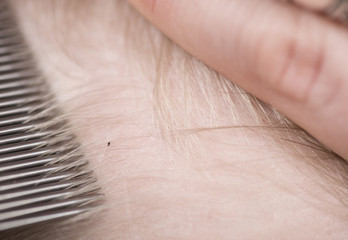 Inspecting childs head for lice - obrazy, fototapety, plakaty