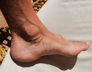 hallux foot