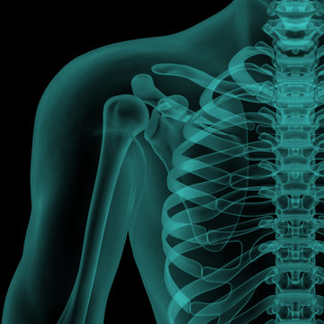 front x-ray view of human shoulder