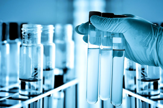 Test tubes in scientist hand with laboratory background