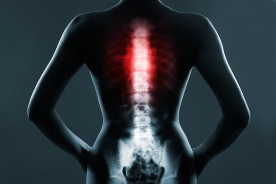 The chest spine is highlighted by red colour