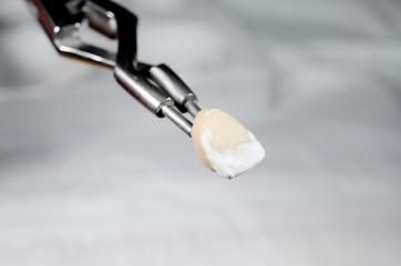 Keramikkrone mit Keramikpulver