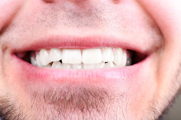 Naklejka premium Smiling man after visit dentist om blurred background, macro