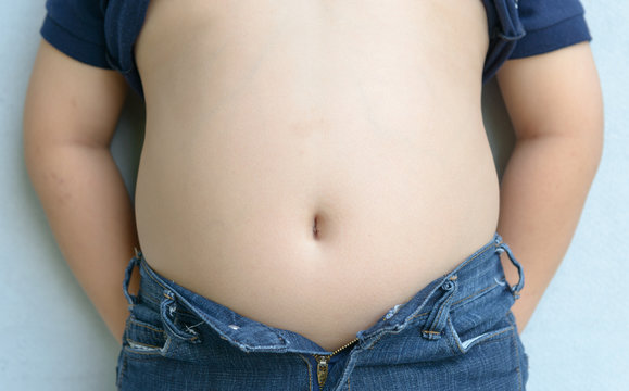 The size of stomach of children with overweight.