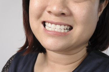 Woman showing healthy tooth