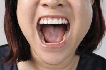 Woman showing healthy tooth