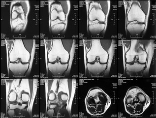 x-ray film