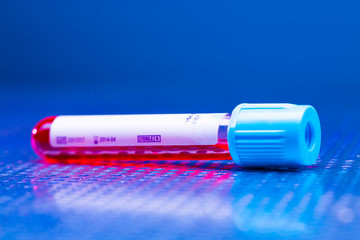 scientific test tube in a laboratory