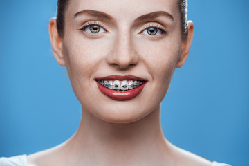 Happy beautiful girl with braces