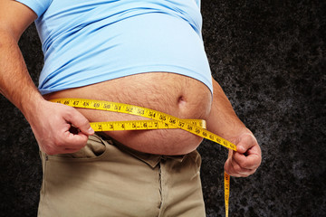 Obesity.