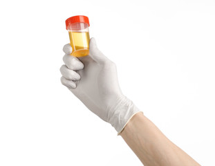 hand doctor in white gloves holding container of urine analysis