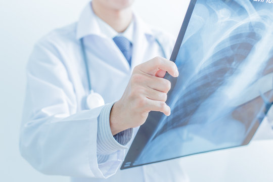 close up of male doctor holding x-ray or roentgen image