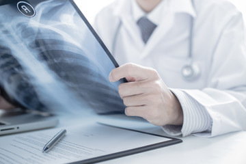 close up of male doctor holding x-ray or roentgen image