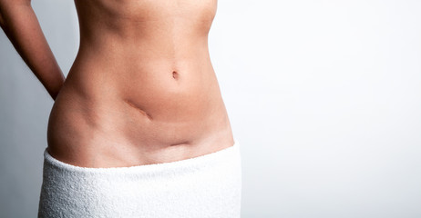 Bauch einer attraktiven Frau mit Narben