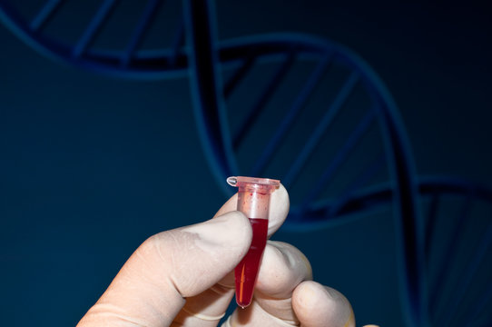 DNA testing of the blood.