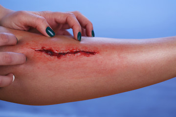 Injured leg with blood on blue background