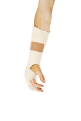 Broken arm bone in cast. Isolated on white background