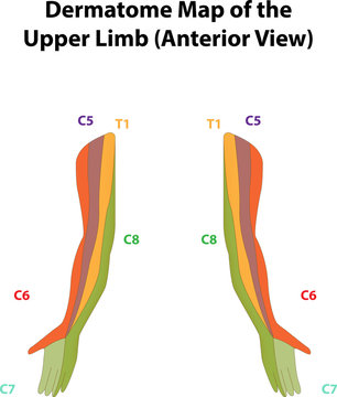 Dermatome Map of the Upper Limb