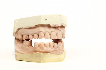 plaster cast of a human jaw