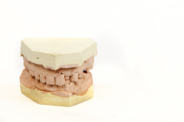 plaster cast of a human jaw