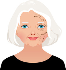 Elderly woman cosmetic rejuvenation of the face lift
