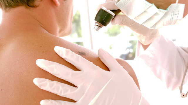 Doctor checking a mole on patient