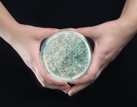 Hands Holding Agar Plate With Bacterial Colonies