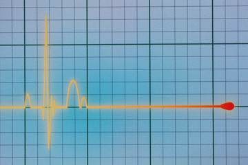 ECG / EKG monitor
