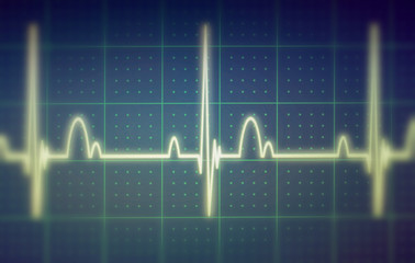 ECG / EKG monitor