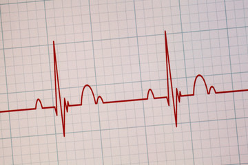 ECG / EKG monitor
