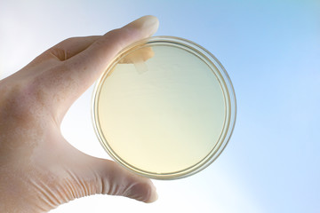 scientist with a hand holding a petri dish