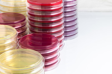 workbench of laboratory with petri dishes for culture
