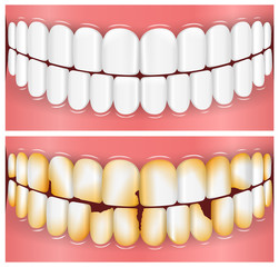 Teeth, Mouth, Dentistry - 79703376