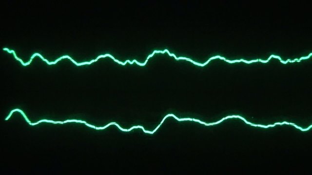 Low frequency on a two channel oscilloscope 02