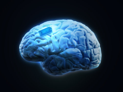 Human Brain Implant