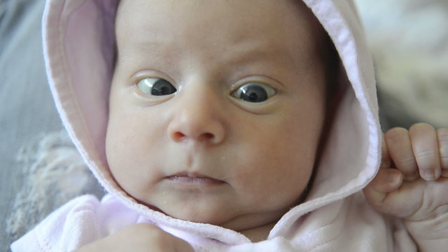 Close-up of baby's face with cross eyed