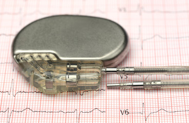Pacemaker on electrocardiograph