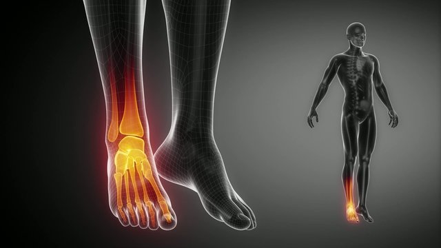 ANKLE joint skeleton x-ray scan in black