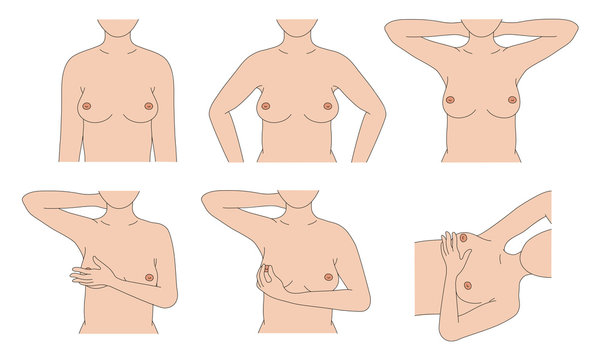 Breast self exam