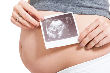 Pregnant woman displaying a prenatal ultrasound