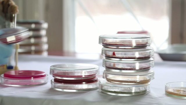 Technician sorting Petri dishes in medical laboratory