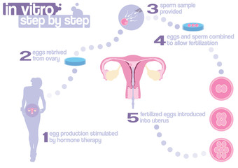 Scheme of in vitro fertilization - obrazy, fototapety, plakaty