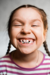 Girl with dental braces