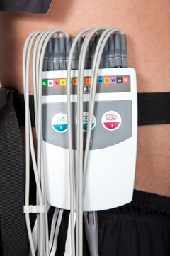 Electrocardiograma