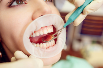 The dentist treats teeth beautiful girl