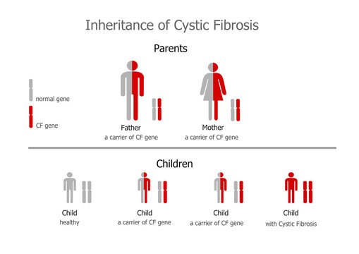 Cystic Fibrosis (mucoviscidosis) - Inheritance