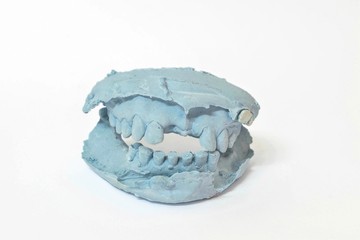 variety of dental plaster molds