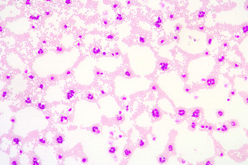 A blood smear is often used as a follow-up test to abnormal resu